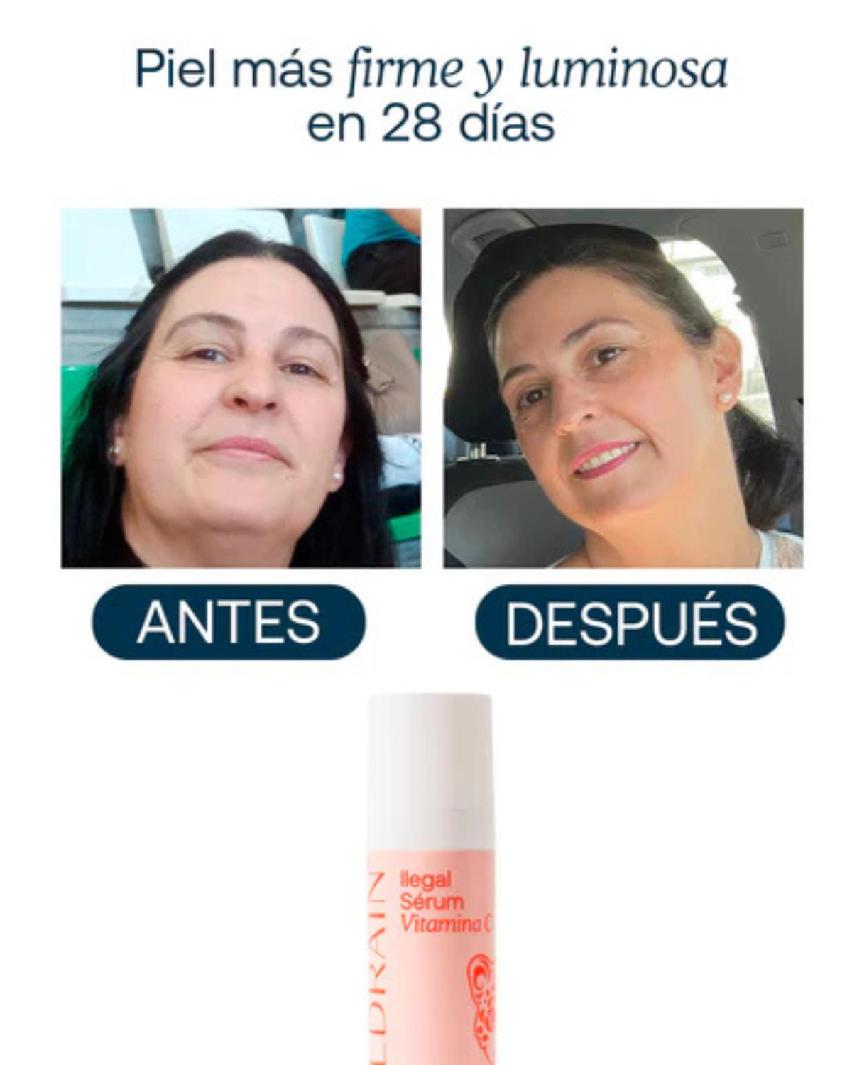 Sérum de Vitamina C Estável para Manchas, Luminosidade e Firmeza ILEGAL