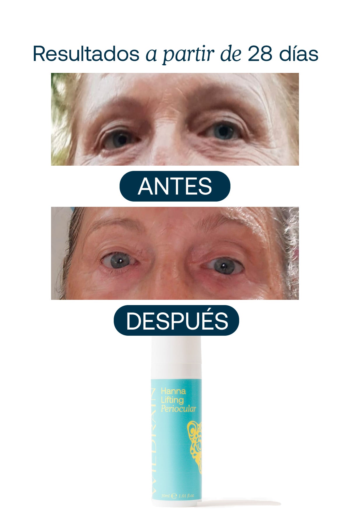Contorno de Ojos Bolsas, Ojeras, Párpado Caído y Arrugas Hanna