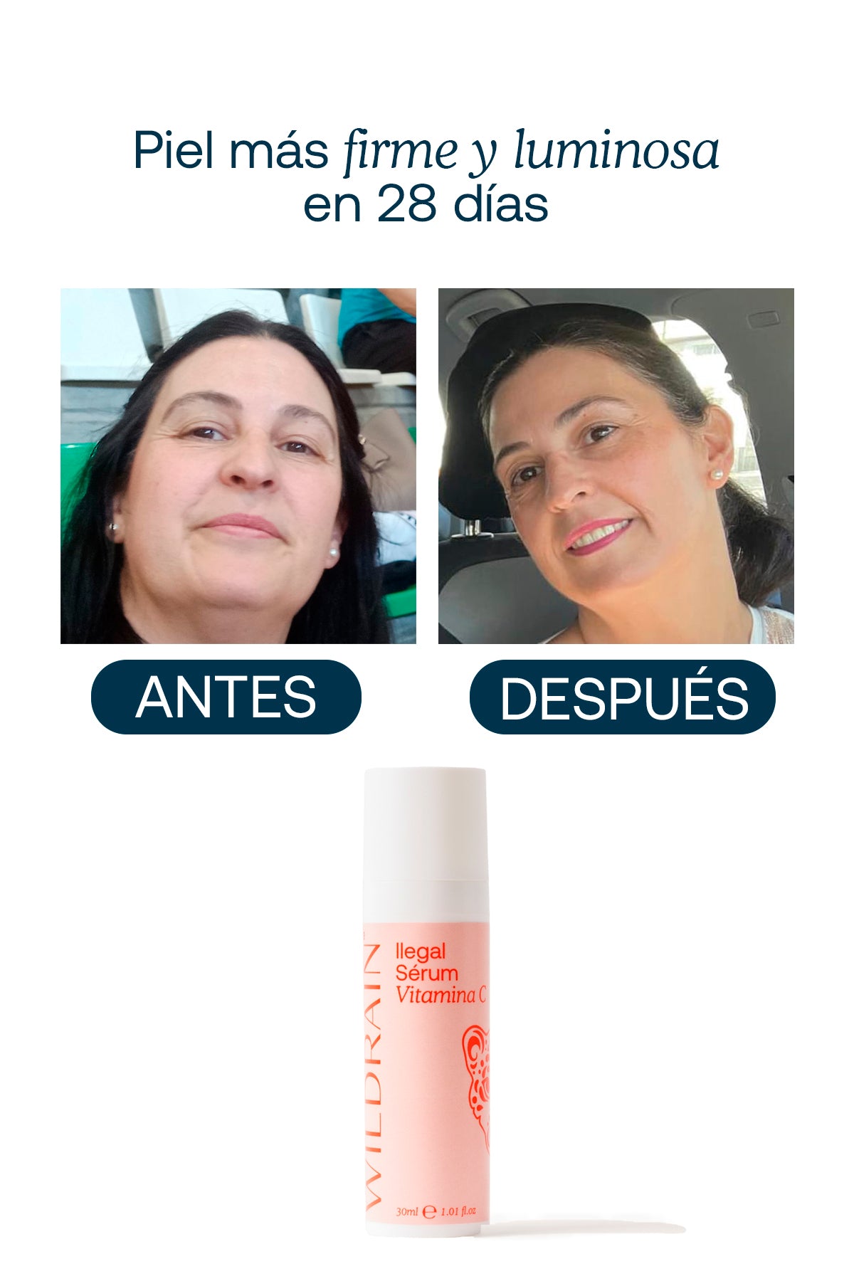 Sérum de Vitamina C Estable para Manchas, Luminosidad y Firmeza ILEGAL