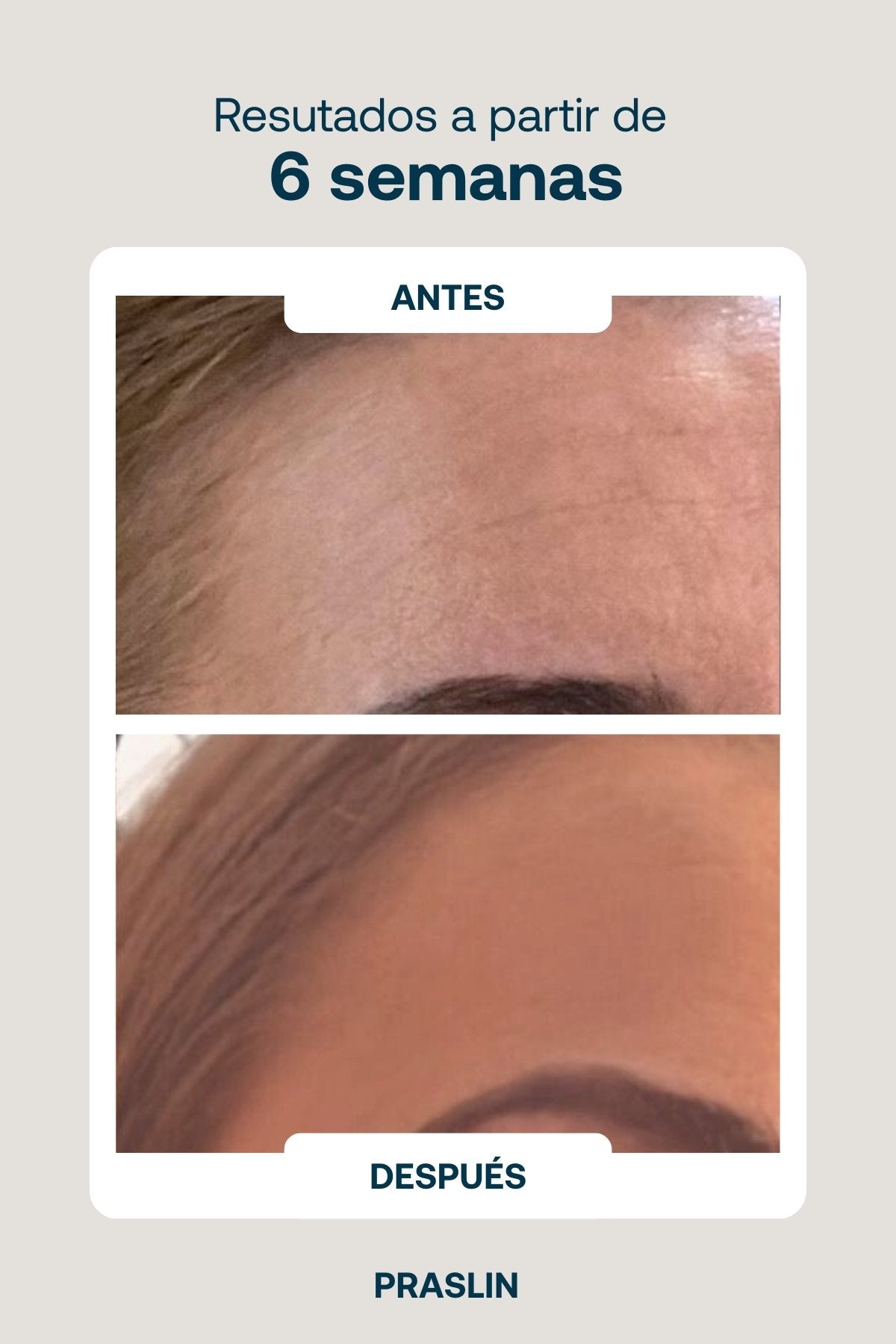 Reafirmante Antiedad para Flacidez y Óvalo Facial Efecto Lifting Praslin
