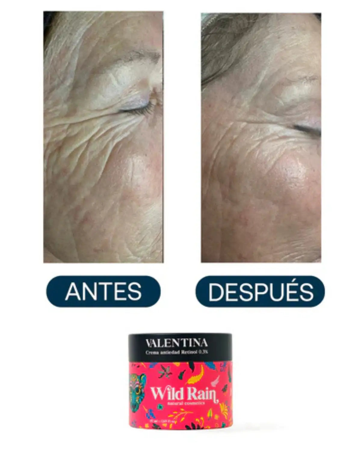 Creme facial com retinol 0,3% antienvelhecimento para rugas, manchas e textura da pele, VALENTINA