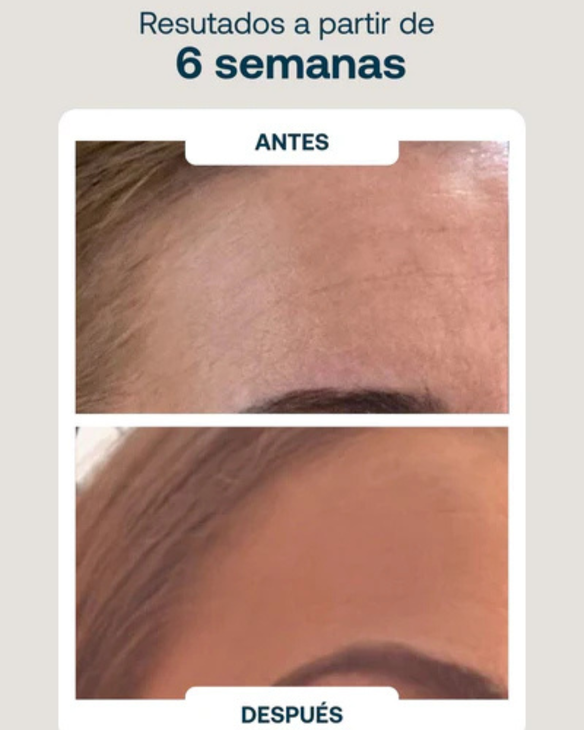 Anti-aging Firming Cream for Sagging Skin and Facial Contours with Lifting Effect Praslin