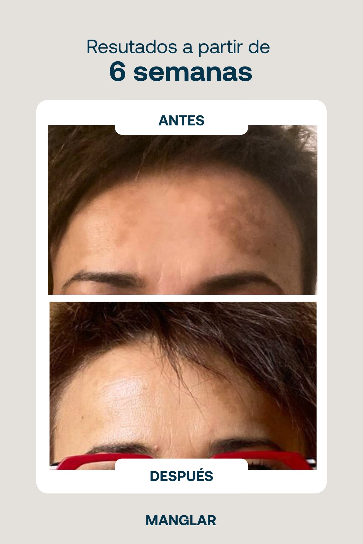 Agente Despigmentante de Mangue 50 ml