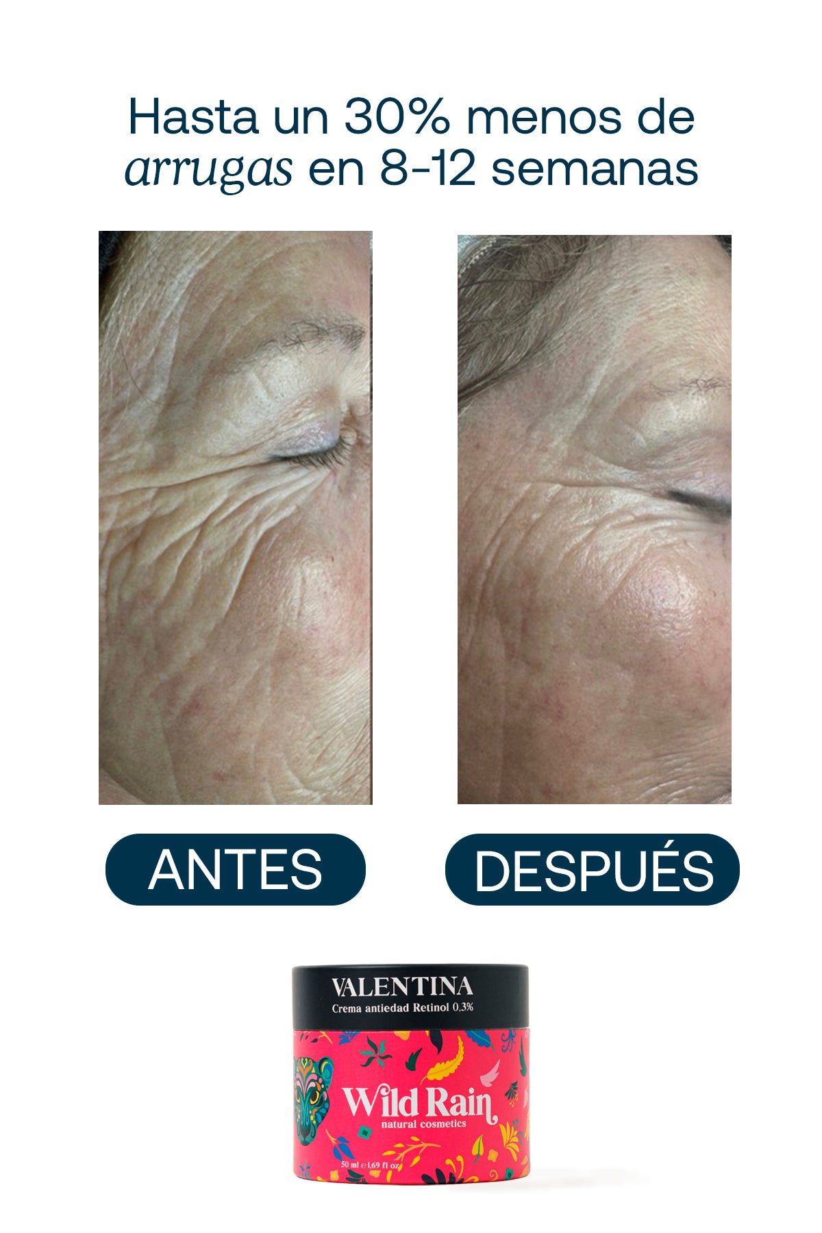Crema facial de Retinol 0,3% Antiedad para Arrugas, Manchas y Textura de la Piel, VALENTINA
